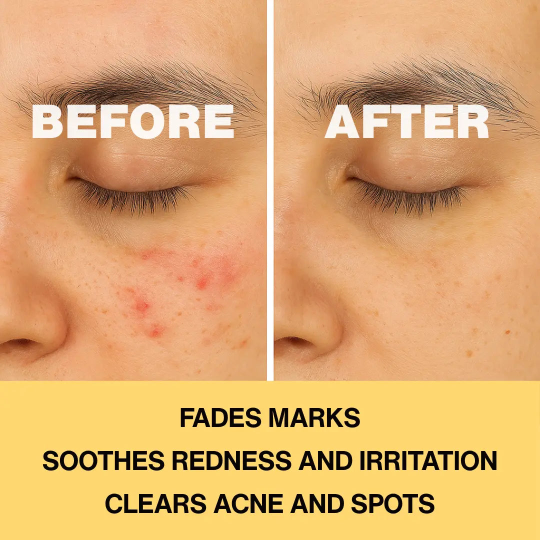 Infinite Aura Holist