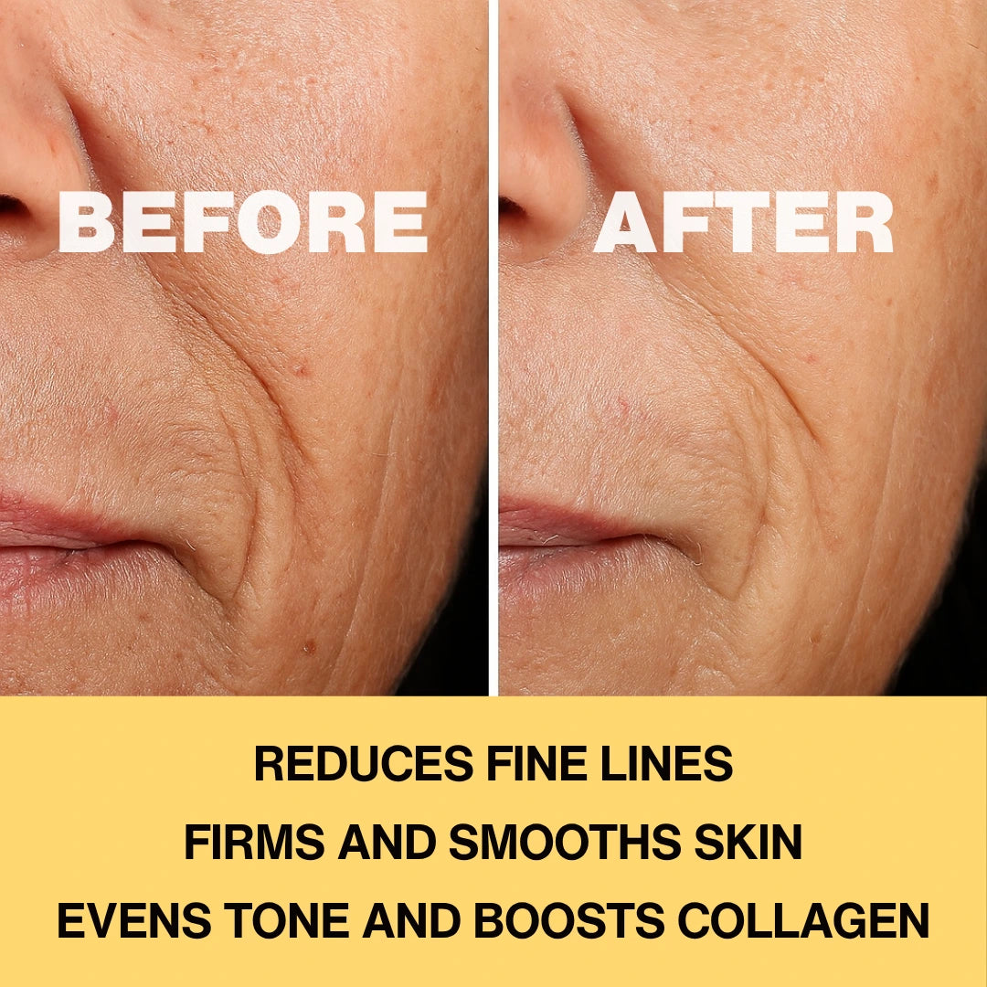 Infinite Aura Holist