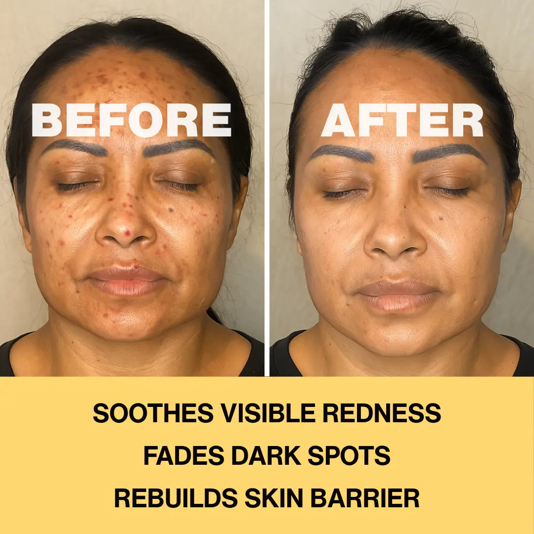 Infinite Aura Holist