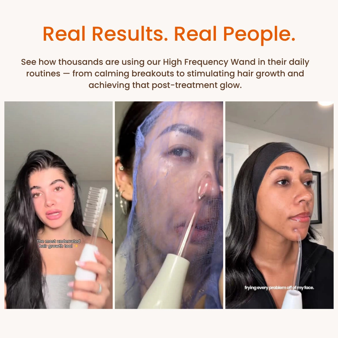 High Frequency Skin Therapy Wand